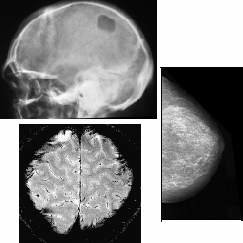 Editronic International - Distributie si service aparatura medicala radiologica